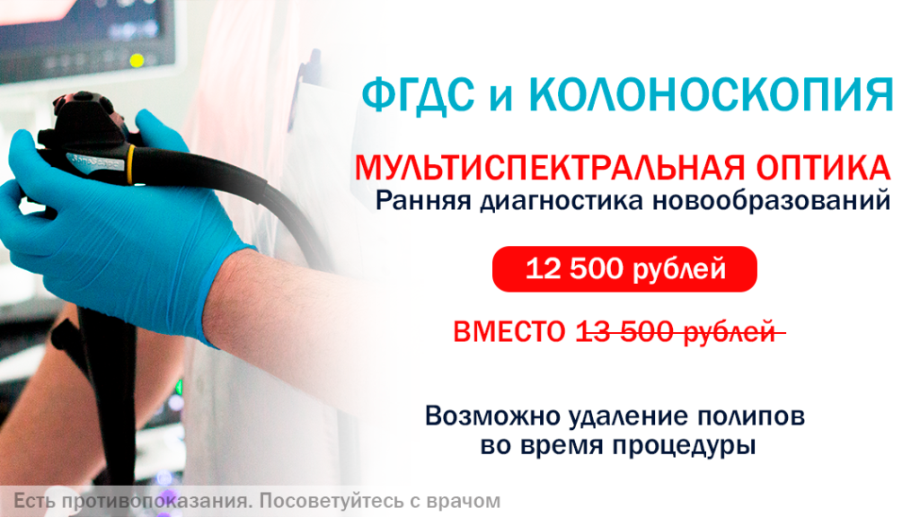 эндоскопия общая.png